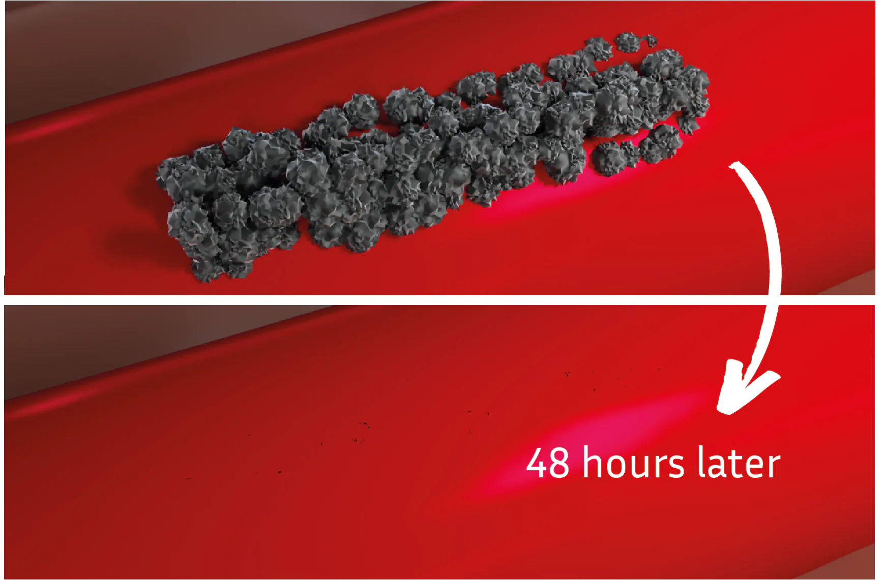 Curaseal Mechanism Step 04
